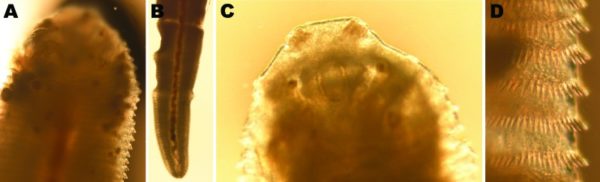 Tongue worms, they're not just for reptiles.....humans too! - The